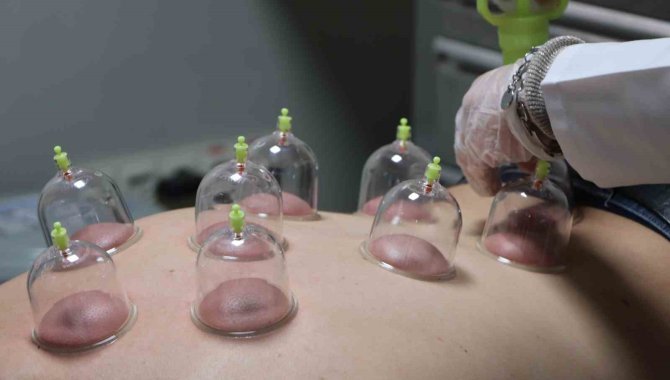 Hacamat, sülük, akupunktur… Bakanlık bünyesinde enstitü kuruldu, geleneksel tıp geliştirilecek